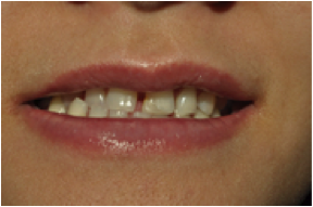 PICTURE 2L